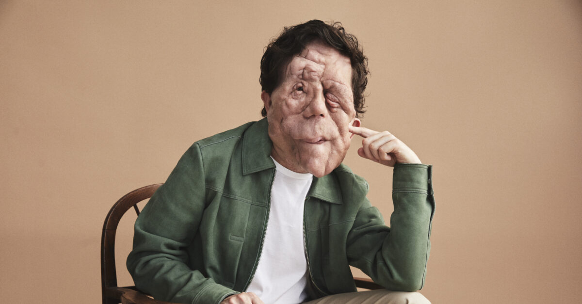 Adam Pearson Will Star in The Elephant Man Film Adaptation Playbill